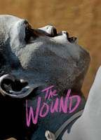 The Wound